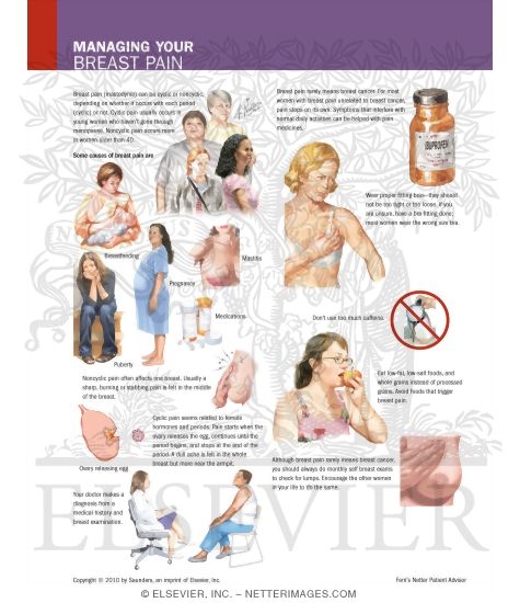 Managing Your Breast Pain