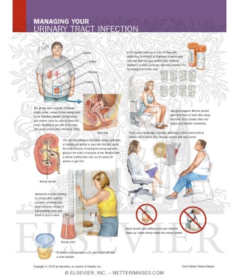 Managing Your Nongonococcal Urethritis