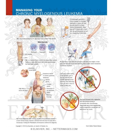 Managing Your Chronic Myelogenous Leukemia