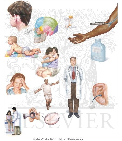 Managing Your Mastoidoitis