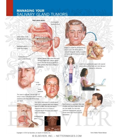 Managing Your Salivary Gland Tumors