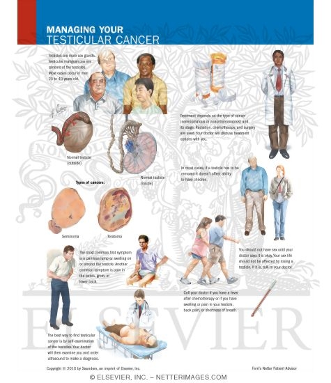 Managing Your Testicular Cancer