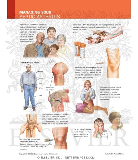 Managing Your Septic Arthritis