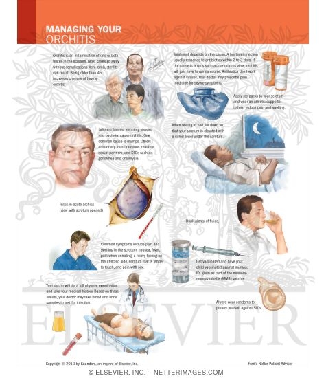 Managing Your Orchitis