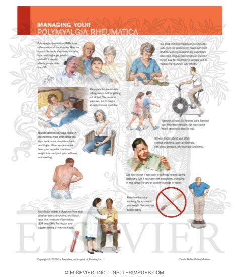 Polymyalgia Rheumatica