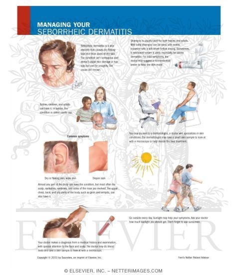 Managing Your Seborrheic Dermatitis