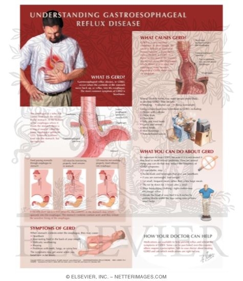 Understanding Gastroesophageal Reflux Disease (GERD)