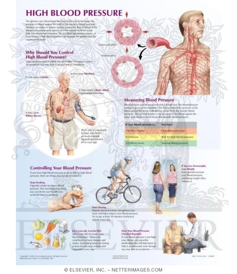 blood pressure chart. High Blood Pressure