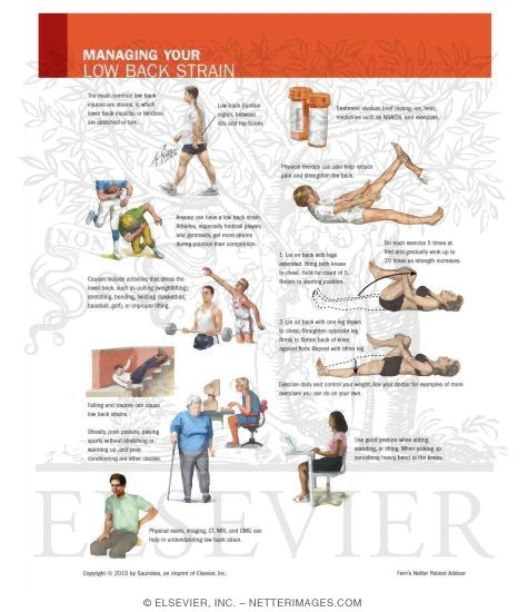 Managing Your Low Back Strain