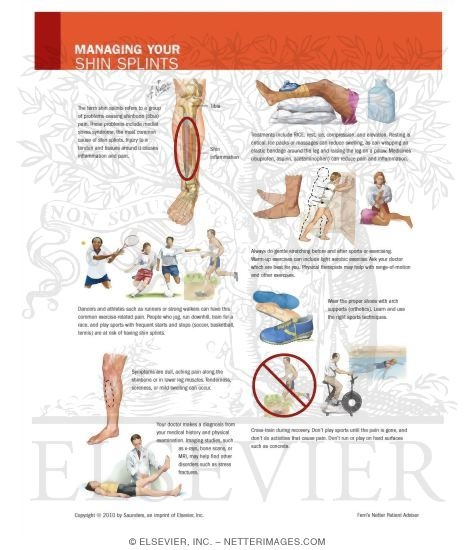 Managing Your Shin Splints