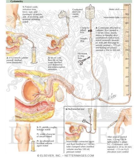 Cystometry