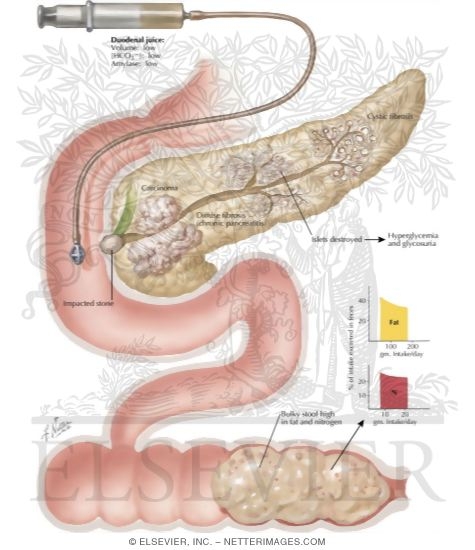 Biochemical Changes in Pancreatic Obstruction