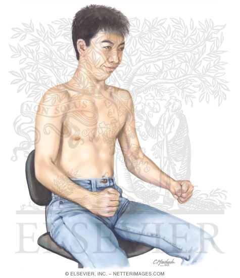 Isometric Exercise