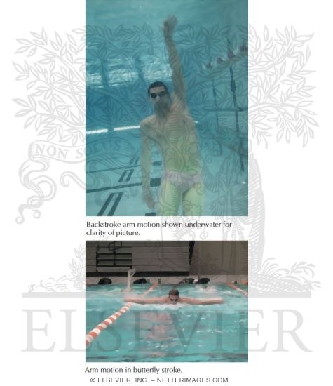 Swimmer's Shoulder