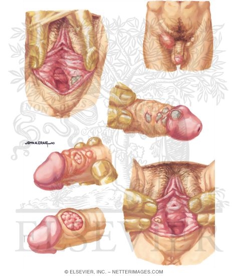 home helpful links sexually transmitted infections home helpful links sexually transmitted infections