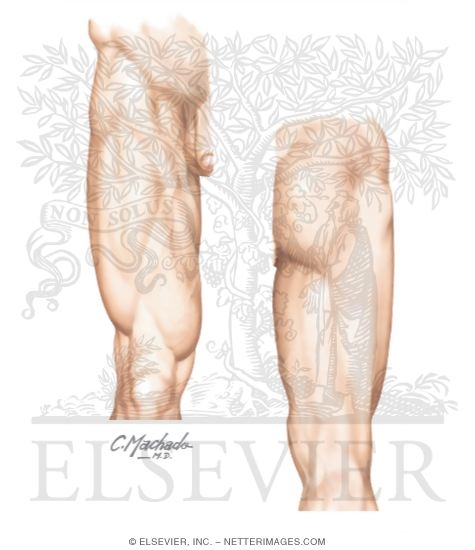 Topographic Anatomy of the Thigh and Hip
