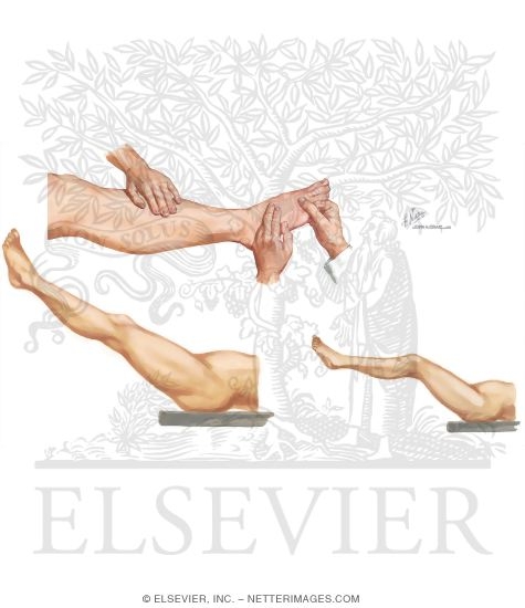 Physical Examination of the Leg