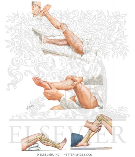 Physical Examination of the Leg