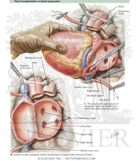 Heart Volume
