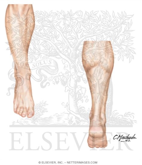 Topographic Anatomy of the Foot and Ankle