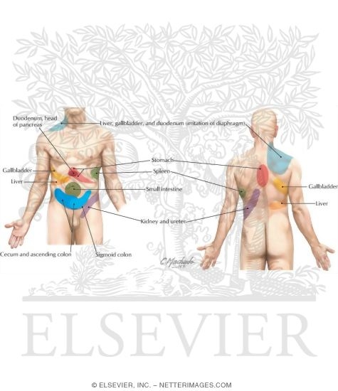 Visceral Referred Pain referred abdominal pain. Visceral Referred Pain