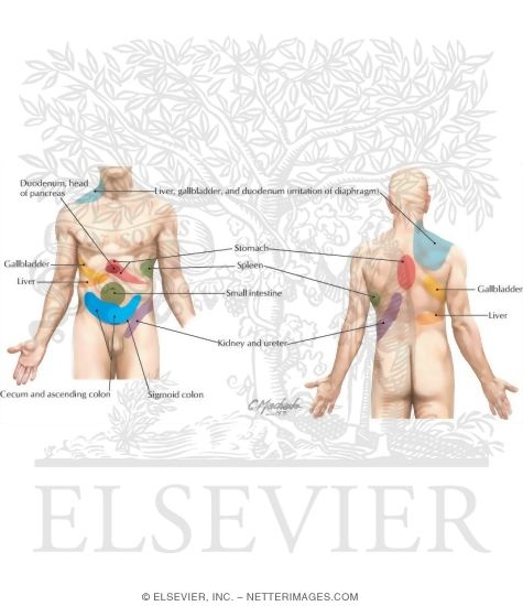 referred abdominal pain. Visceral Referred Pain