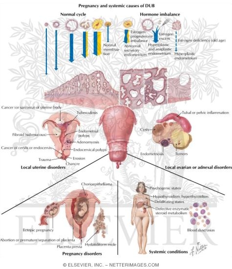 Functional and Pathological Causes of Uterine Bleeding