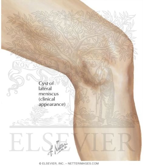 Disorders of the Knee