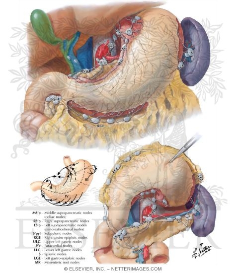 Lymph Vessels and Nodes of Stomach