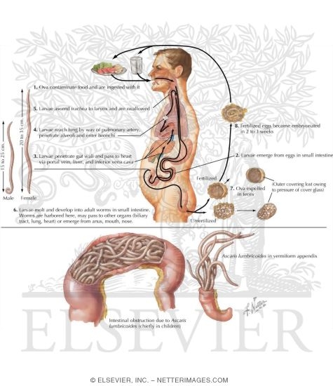 Ascariasis: Life Cycle of Ascaris lumbricoides