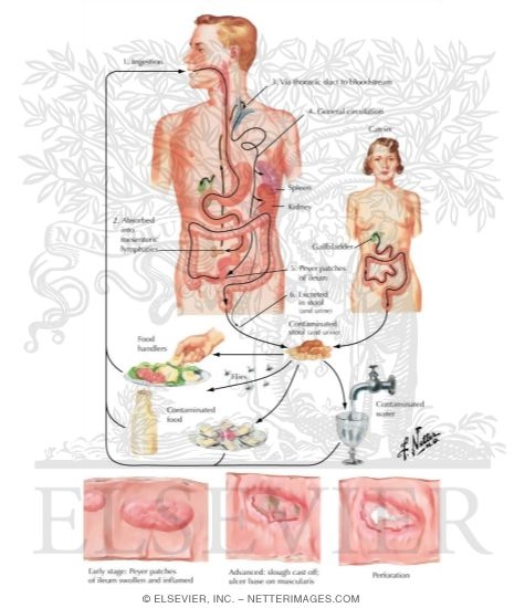 Transmission of Typhoid Fever