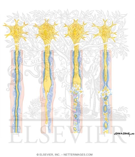 Axon Regeneration