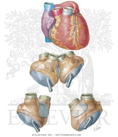 human heart labeled. Human Heart Compared to Jarvik