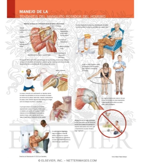 Manejo de la Tendinitis Del Manguito Rotador Del Hombro
