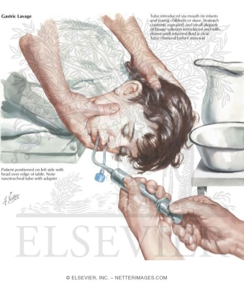 The Treatment of Poisoning