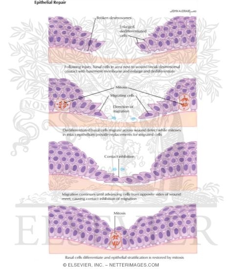 Epithelial Repair