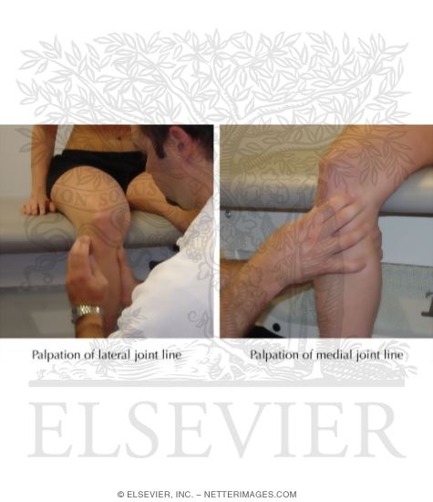 Palpation of Joint Lines