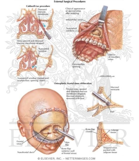 External Surgical Procedures
