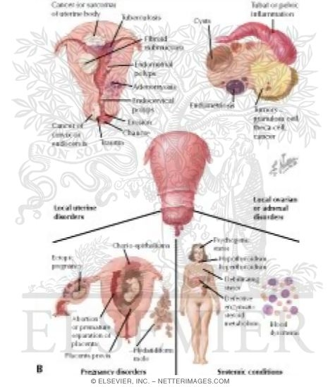 Abnormal Uterine Bleeding