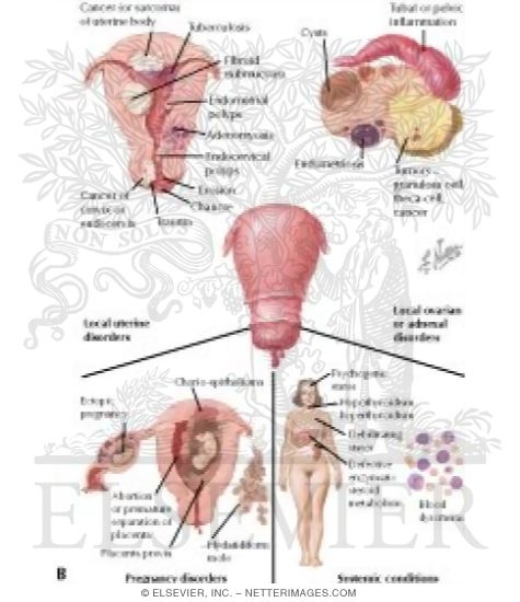 dysfunctional uterine bleeding