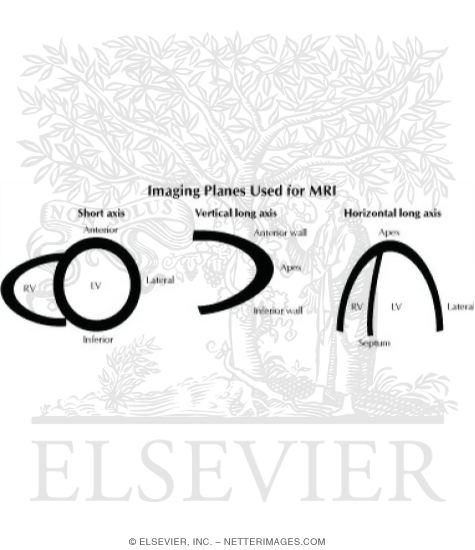 Imaging Planes Used for MRI