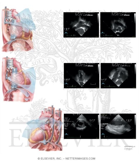 Transesophageal Echocardiography: Positions
