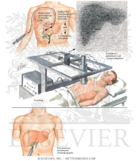 Liver Scanning and Transhepatic Cholangiography