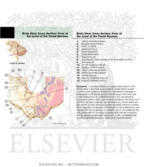Brain Stem Cross Section: Pons at the Level of the Facial Nucleus
