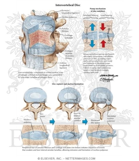 Intervertebral Disc