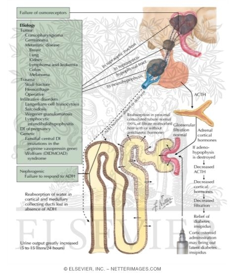 Central Diabetes Insipidus																																																																																																																																																																																																																																																				