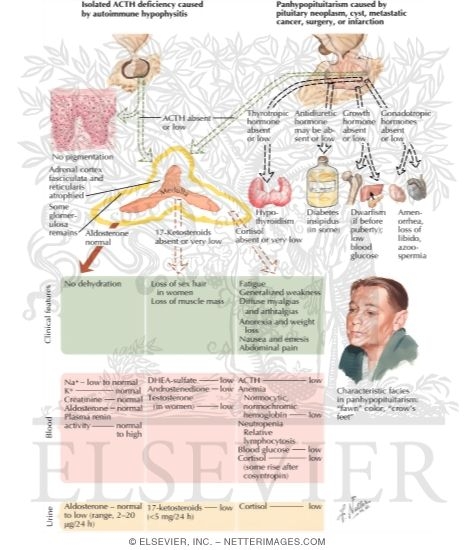 Laboratory Findings and Treatment of Secondary Adrenal Insufficiency