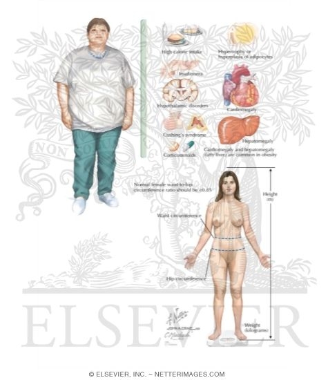 Obesity																																																																																																																																																																																																																																																				