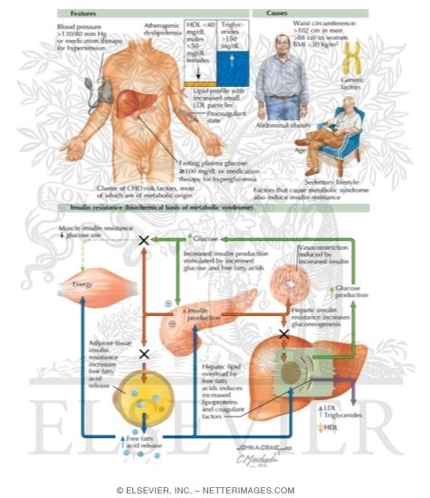 Metabolic Syndrome																																																																																																																																																																																																																																																				