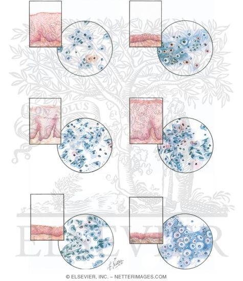 Vagina: Cytology